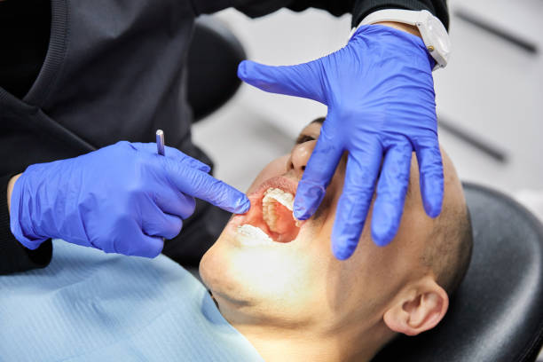 Best Dentist for Tooth Abscess  in Lowellville, OH